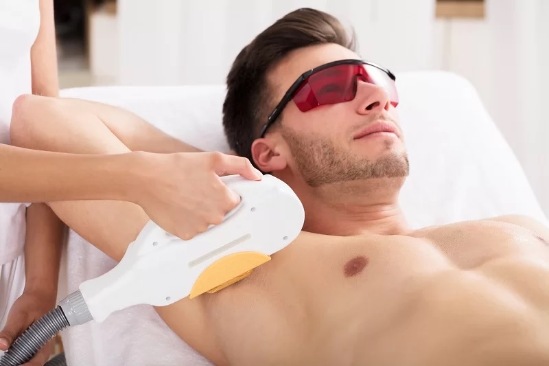 Laser Acne Treatments